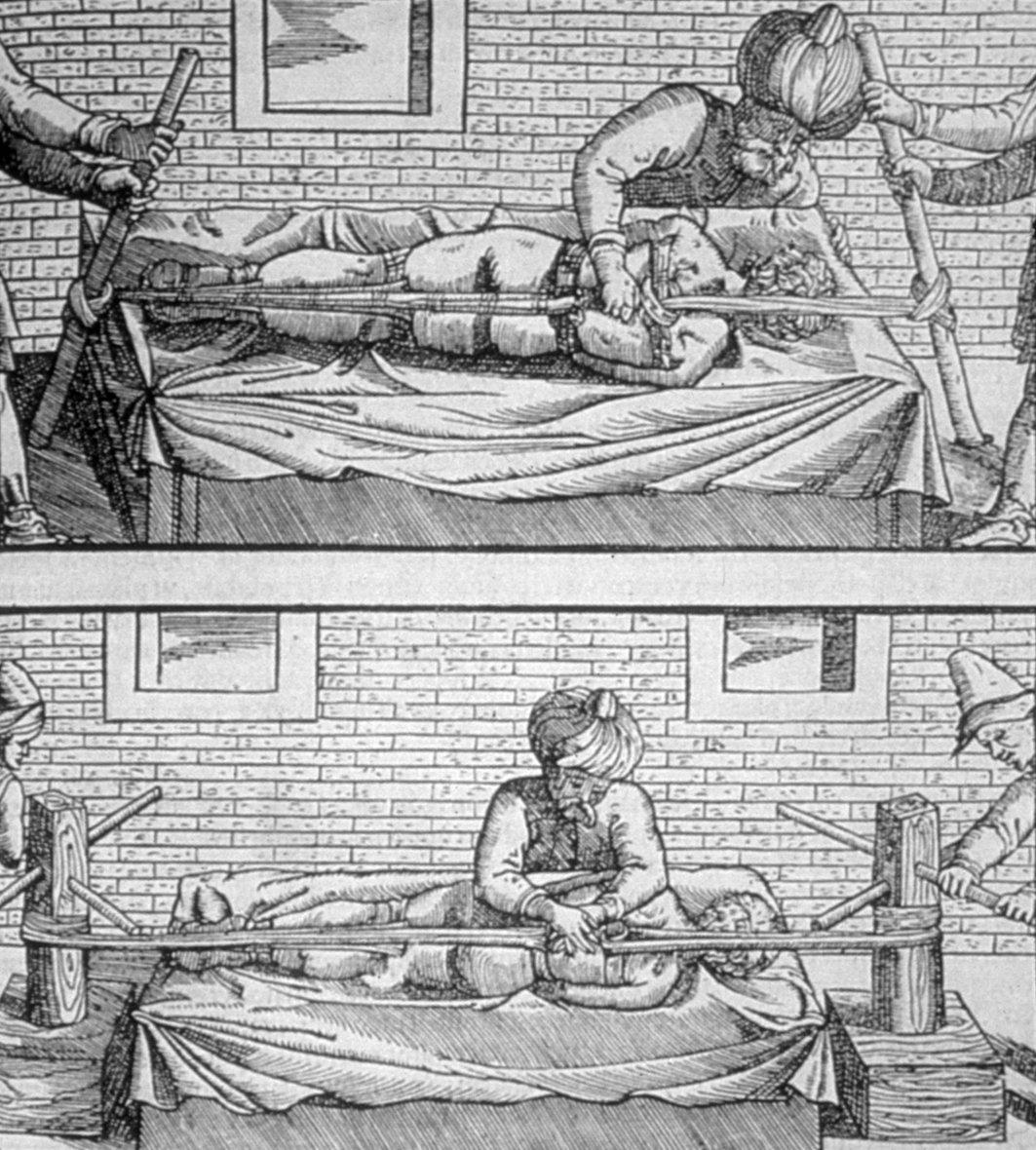 İbn Sînâ’nın el-Ḳānûn fi’ṭ-ṭıbb’ının Andreas Alpago tarafından yapılan Latince tercümesinin 1544 yılı Venedik baskısında “luksasyon”ların (çıkık) İbn Sînâ’ya göre tedavisine ait resimler
