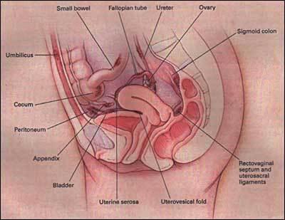 endometriosis_figure1.jpg