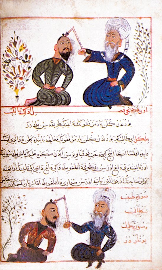 Sabuncuoğlu Şerefeddin’in Cerrâhiyye-i İlhâniyye adlı eserindeki, XV. yüzyıl Osmanlı tıbbı ve cerrahlığının seviyesini yansıtan minyatürlü bir sayfa (Millet Ktp., Tıp, nr. 79/353, vr. 24b)