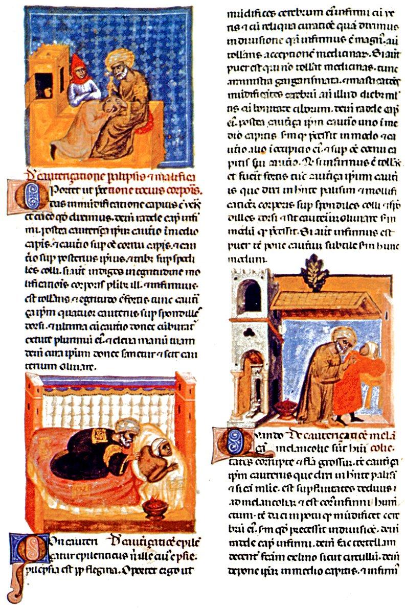 Ebü’l-Kāsım ez-Zehrâvî’nin et-Taṣrîf li-men ʿaceze ʿani’t-teʾlîf adlı tıp ansiklopedisinin XII. yüzyıl ortasında Gerhardo Cremona tarafından yapılan Latince tercümesinden bir sayfa (Österreichische Nationalbibliothek – Viyana/Avusturya)